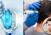 New hair implant technology