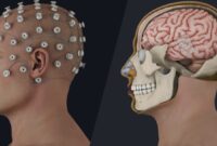 Brain-computer interfaces