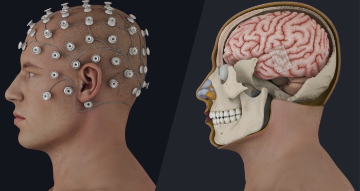 Interfaces Brain-computer interfaces